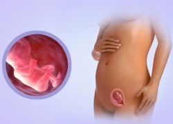 Uterus u 13. tjednu trudnoće