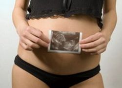 ембрион 16 недеља