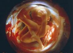 19 týdnů gestační velikosti plodu