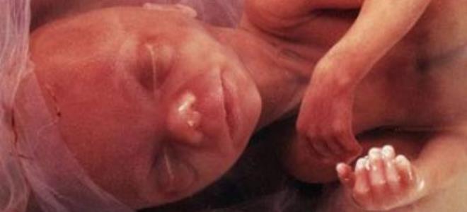 25. tjedan razvoja trudnoće fetusa