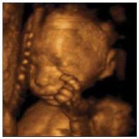 Величина фетуса на 26 недеља