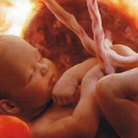 fetusa u 30 tjedana trudnoće