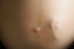 кикотене на 31-та седмица на бременността