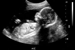 31 tjedan razvoja trudnoće fetusa