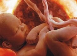 fetusa u trudnoći od 38 tjedana