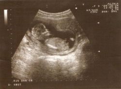 6 tjedana trudnoće što se događa