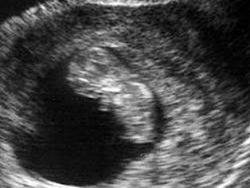 7 tygodni jak płód wygląda