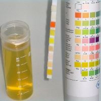testi za aceton v urinu