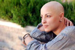 Да ли коса увек пада након хемотерапије