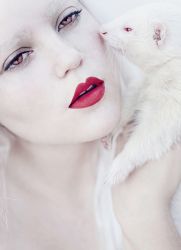 albinizam bolest