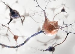 Příčiny Alzheimerovy choroby