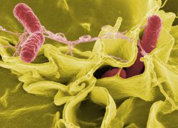 Rodzaje bakterii beztlenowych