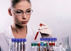 krvni test za sifilis