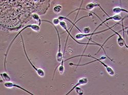 анализ на сперматозоидите