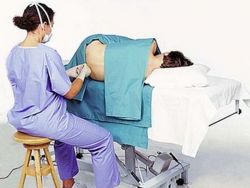 epidurální anestezie během porodu