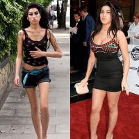 anoreksja przed i po 1