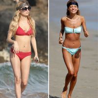 anoreksja przed i po2
