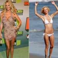 anoreksja przed i po6