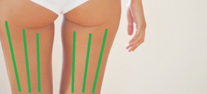 photo4 Anticelulitidní masáž stehen a hýždí s stehenními kostimi фото4 Антицеллюлитный массаж бедер и ягодиц банками бедра сзади