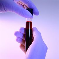 povećana je analiza antitijela krvi na TPO