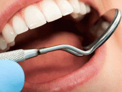 Jak leczyć aftowe zapalenie jamy ustnej