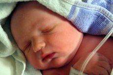 atresija jednjaka u novorođenčadi