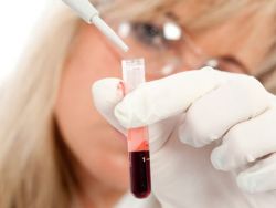 b12 krevní test s nedostatkem anémie