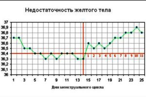 графикон базне температуре 4