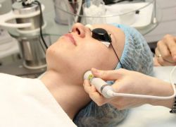 лазерна биоревитализация на лицето