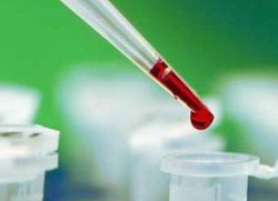 kakšni testi krvi kažejo na raka