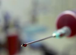 badanie krwi na obecność przeciwciał przeciwko robakom