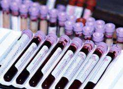 transkripce krevního testu hormonů