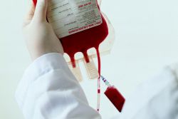 transfuzní účinky krve