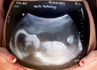 slika tijela za trudnice2