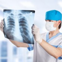 bronchopneumonický rentgen