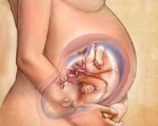 ciąża z urządzeniem domacicznym
