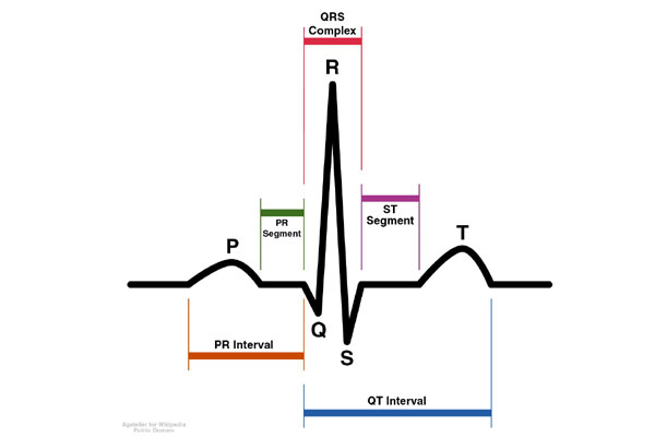 dekodiranje srčne elektrokardiogravne norme