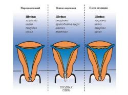 cervikální pozici před menstruací