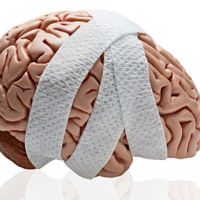 rehabilitacja po urazie czaszkowo-mózgowym