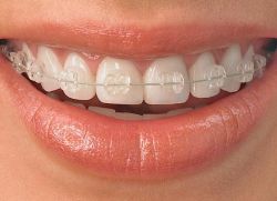 како поправити зубане зубе