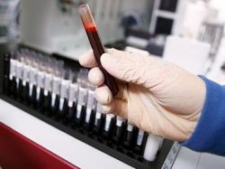 тест крви цитомегаловируса