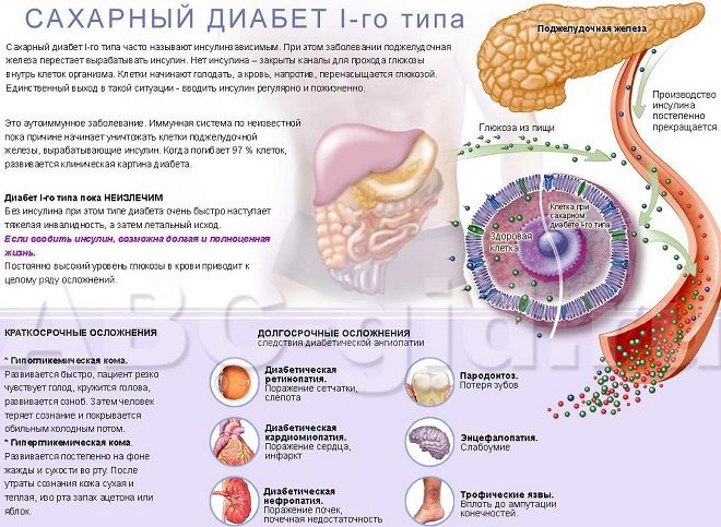 izbornik, dijabetesa tipa 2 i hipertenzija)