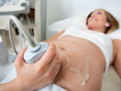 doppler ultrazvuk během těhotenství co to je