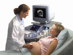doplerometrija za normalne indikatorje nosečnic