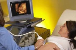 dopplerometria podczas transkrypcji ciąży