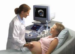 Dopplerometrija med nosečnostjo, kako narediti
