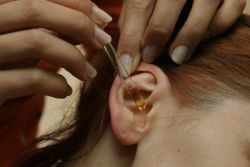 лечение на човешки ушни кърлежи