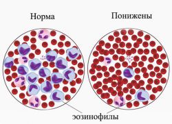 Krevní testy eosinofilů se snížily