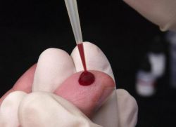 krvne slike rdečih krvnih celic normalno pri ženskah