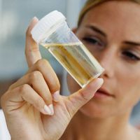 eritrocite v stopnji urina pri ženskah